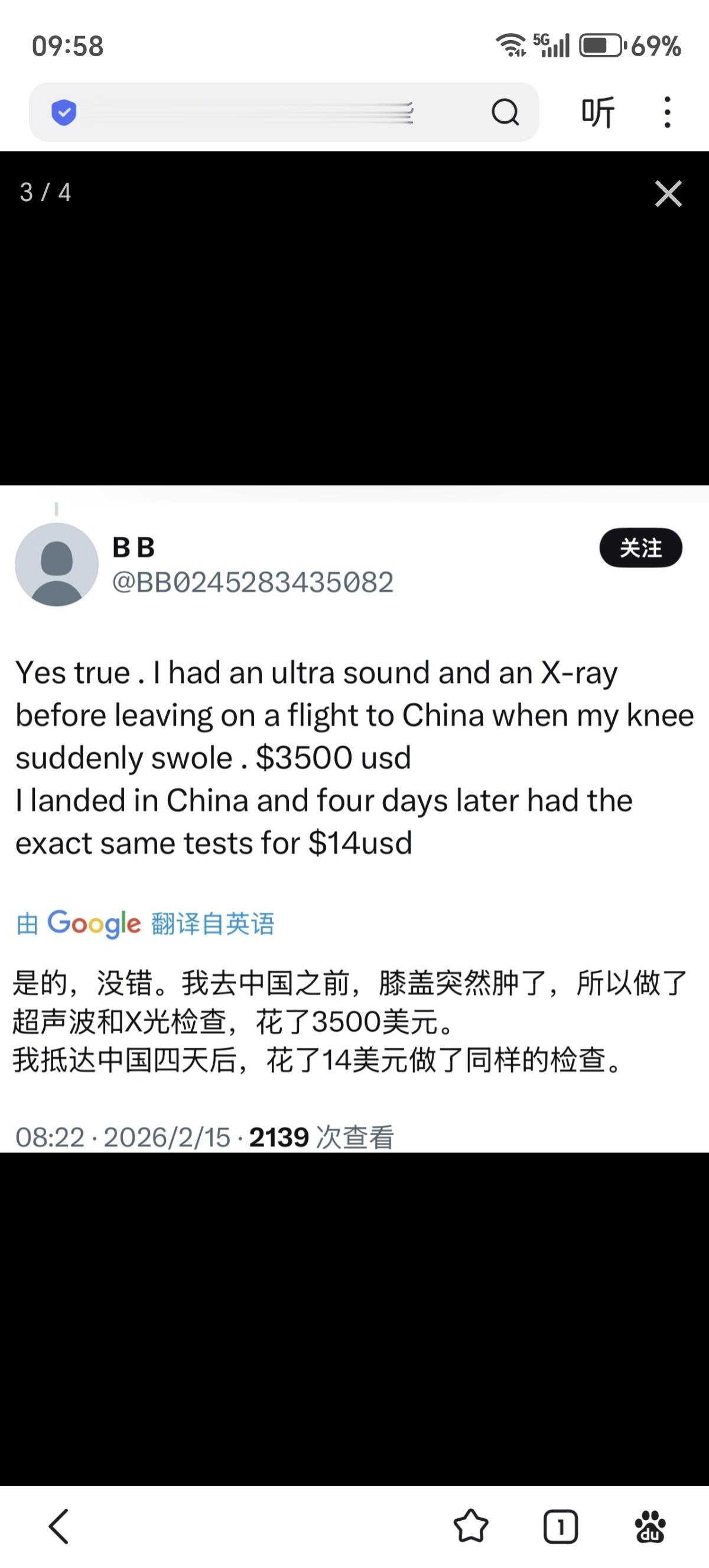 一位国外网友分享了他在中国医院就诊的经历，做一次核磁共振检查只花了480人民币，