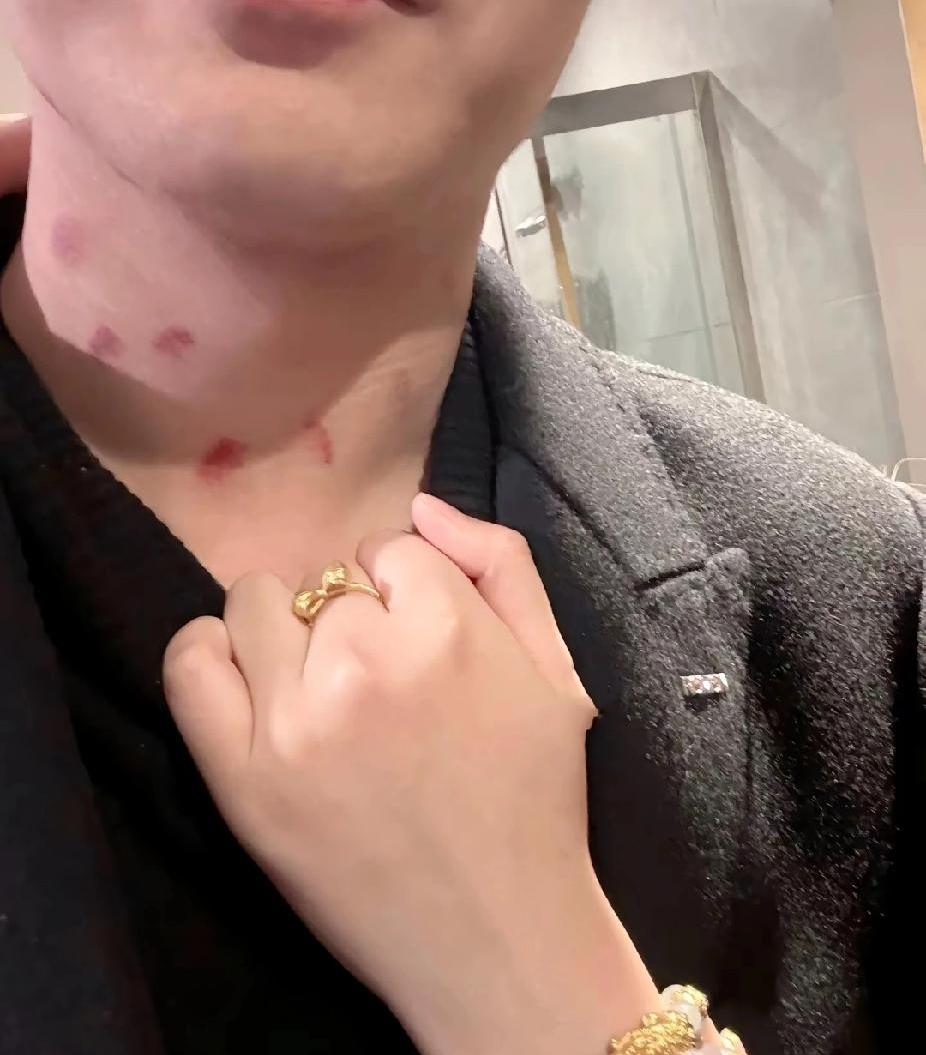 准备睡觉，老公当着我的面正换着睡衣，我盯着他看了三秒说：“老公，你的脖子怎么红了