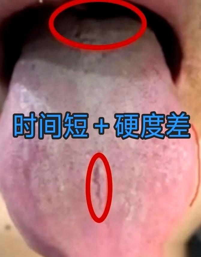 一个大哥，猛灌了10斤补阳药，结果呢？时间还是死死卡在5分钟。
他一脸不服，说自