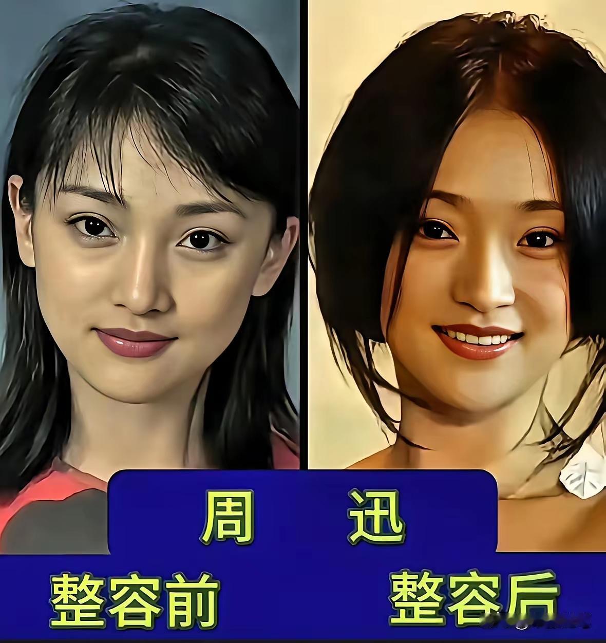 整容后的周迅看起来更精致了
整容后的宁静看起来更白了
整容后的景甜看起来更有气质