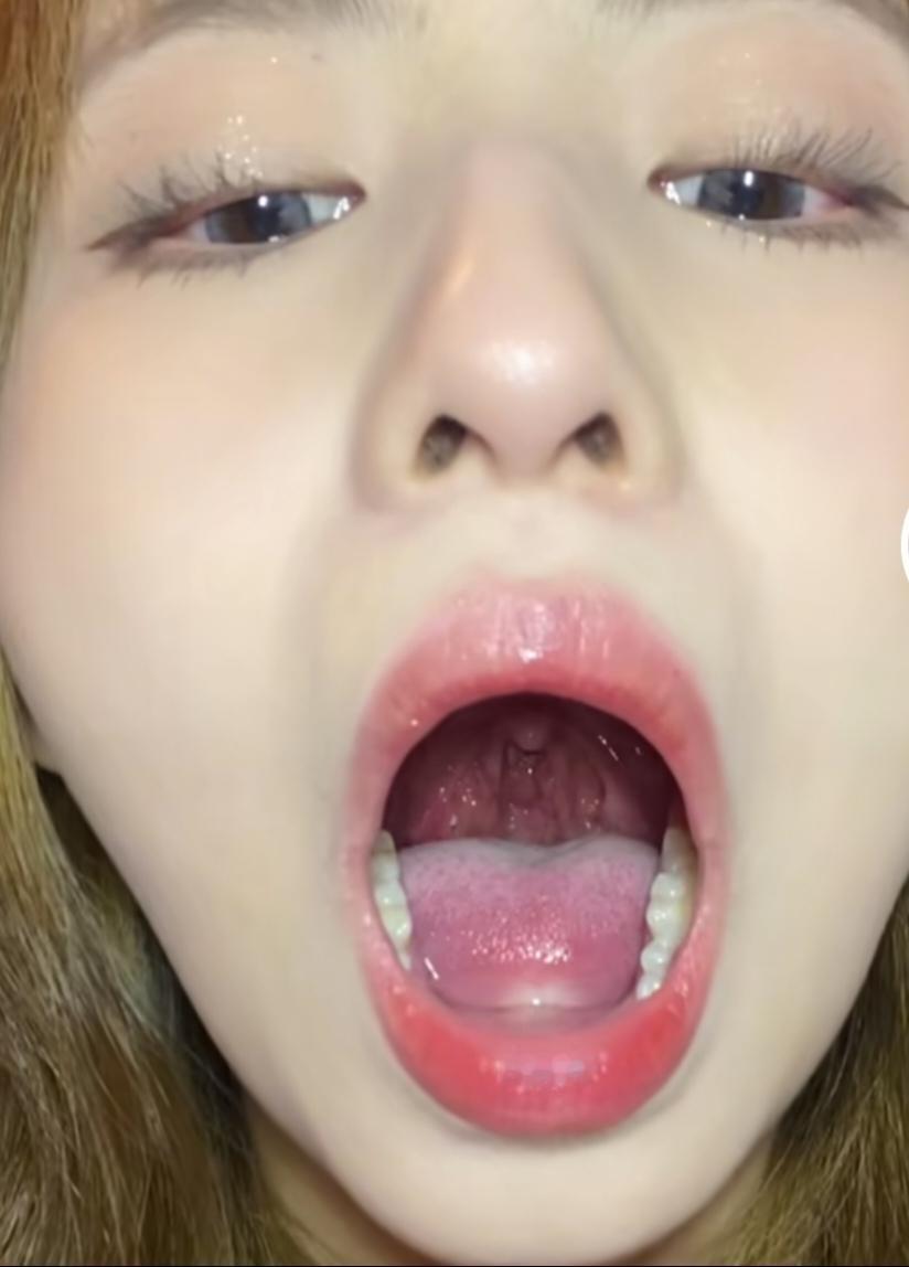 有个事不敢信！上海女子吞枣核，穿透食道险送命…
惊魂一刻！七旬老人误吞枣核险酿大