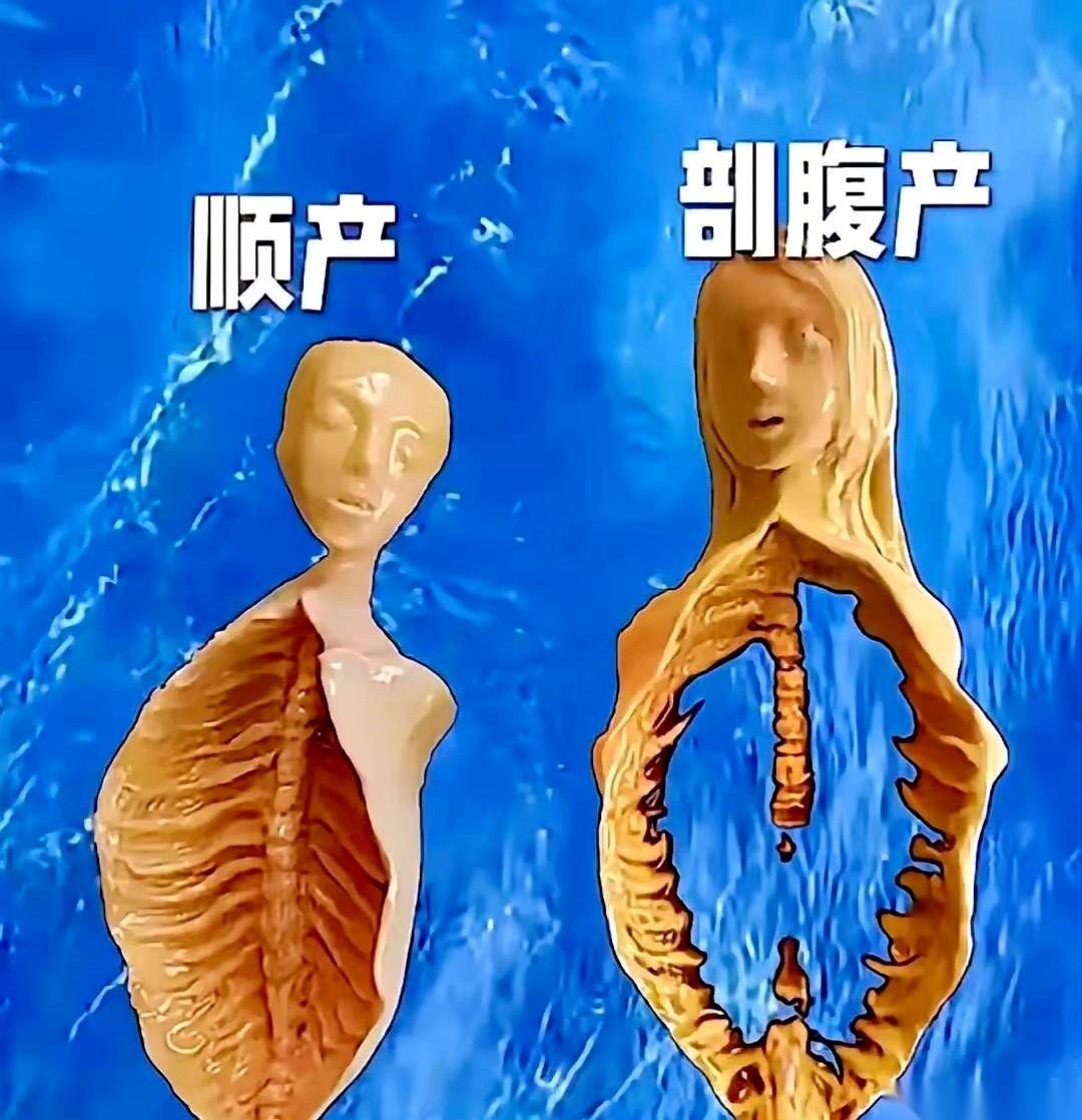 在产科陪了几天床，我才咂摸出一个要命的道理：顺产，是产妇一个人硬扛；剖腹产，是老
