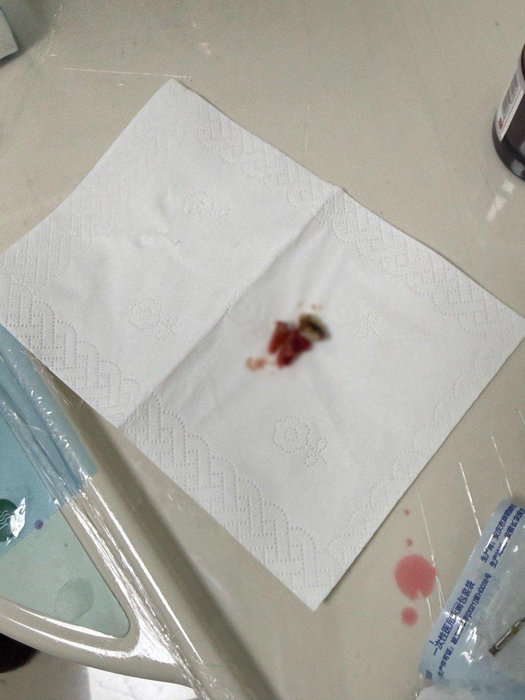 一定保护好牙齿太致命了