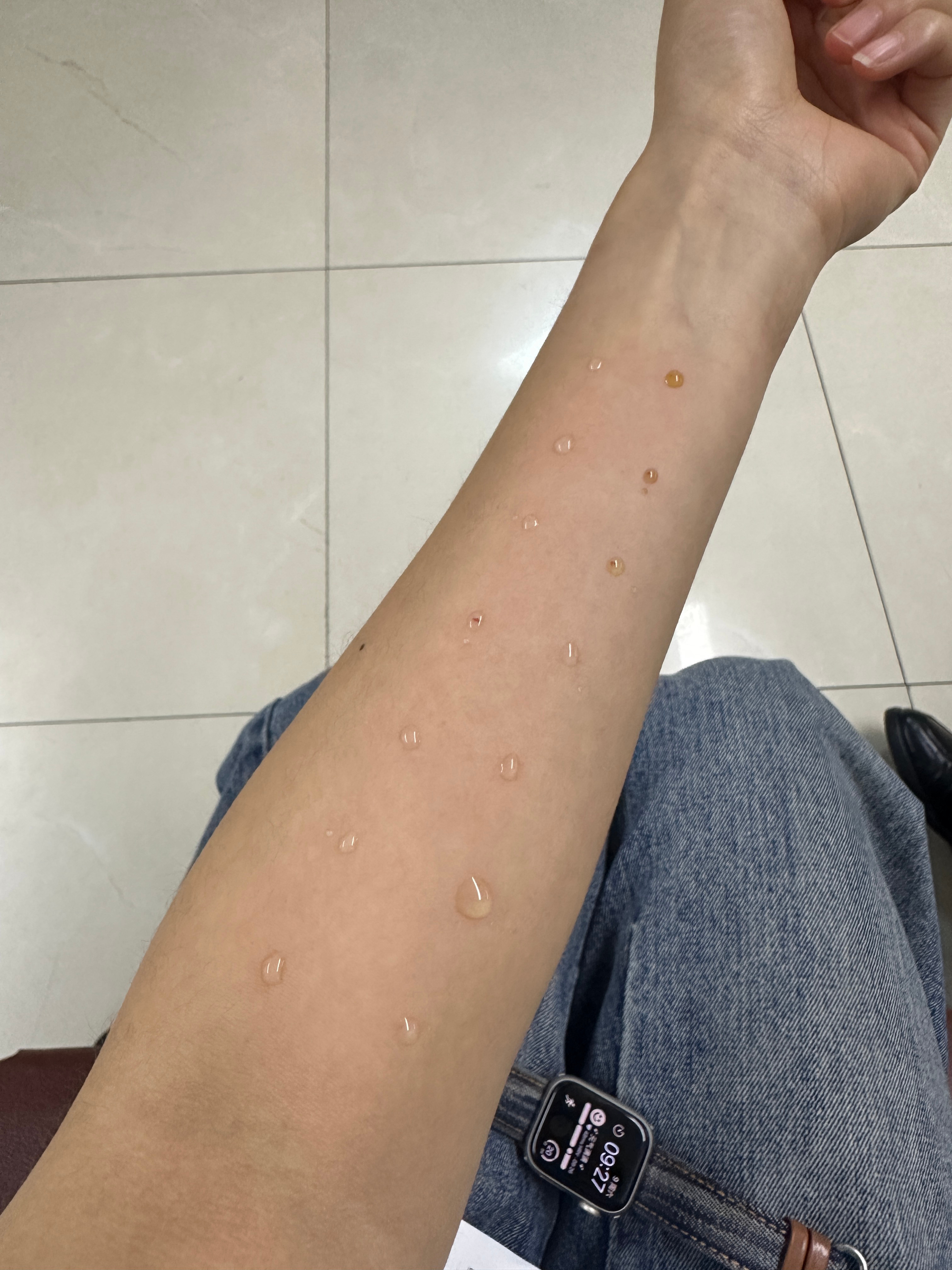 养宠人最无奈的事情大概就是过敏源检测结果居然是自己的可爱糊糊呜呜呜呜呜要不是这次