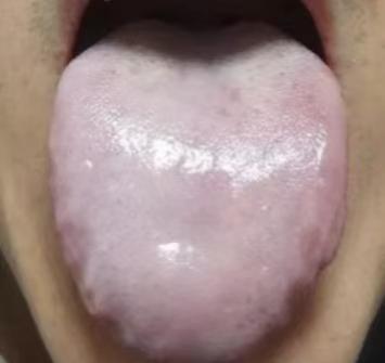 手脚冰凉就猛补阳气？当心！这种“假阳虚”越补越糟，真凶竟是肝在“憋火”！

遇到