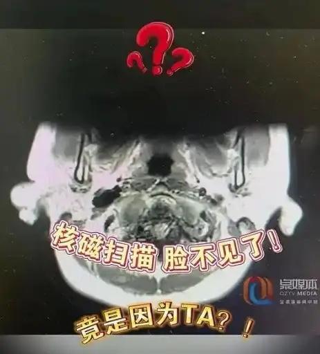 2024年底的河南舞钢，一台挖掘机挖出了1068具遗骸。司机一铲子下去，看到不对