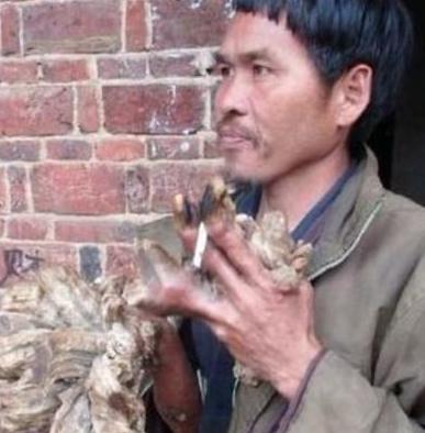 1992年一天深夜，湖南小伙刘忠文突然被痛醒！他连忙起身并打开灯查看，不料，眼前