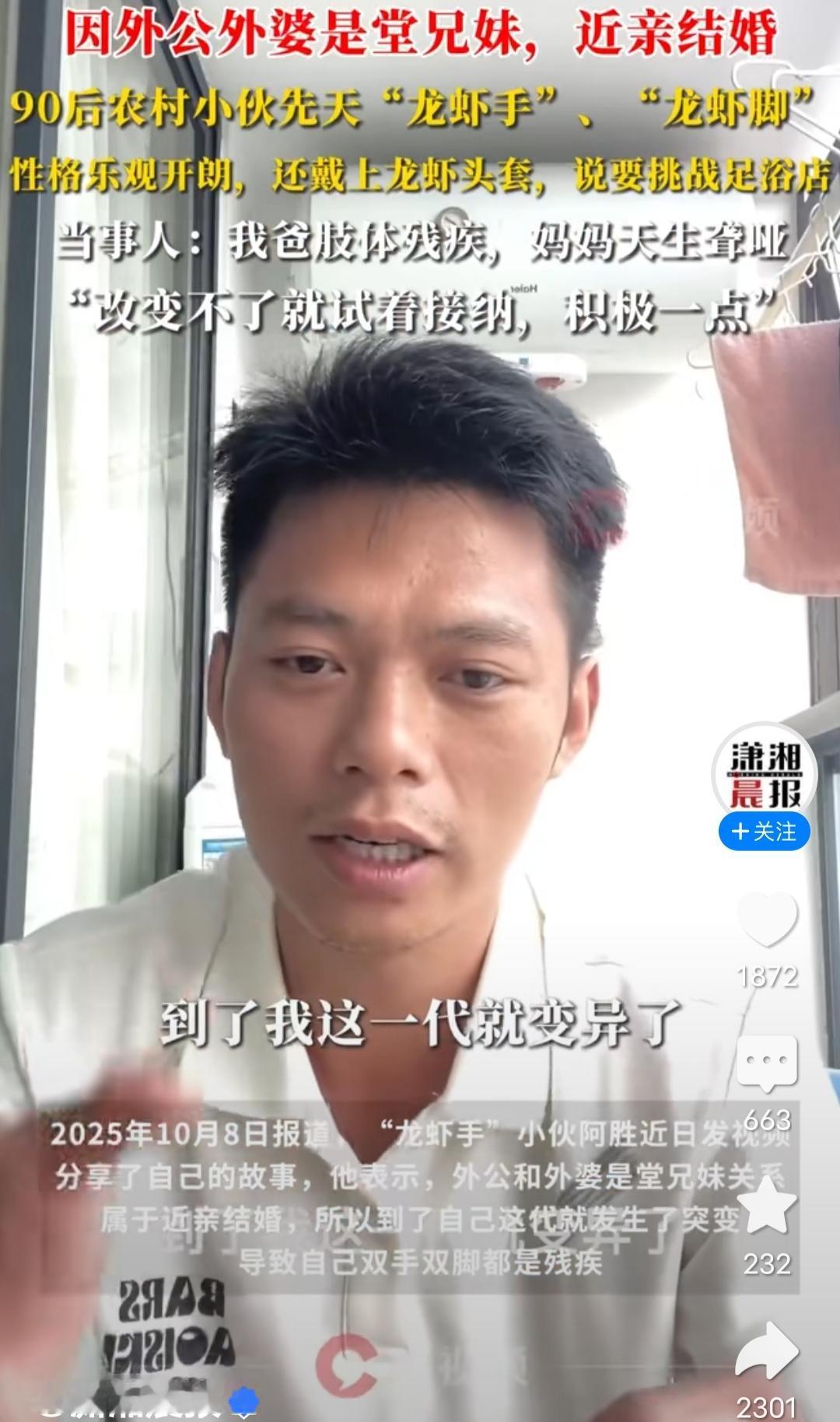 90后农村小伙子天生“龙虾手”“龙虾脚”，性格乐观开朗，还戴上龙虾手套，说要挑战