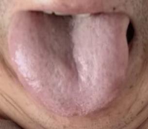 精寒便溏、失眠头晕多为脏腑亏虚，三脏同调改善体虚损耗问题







不少粉丝