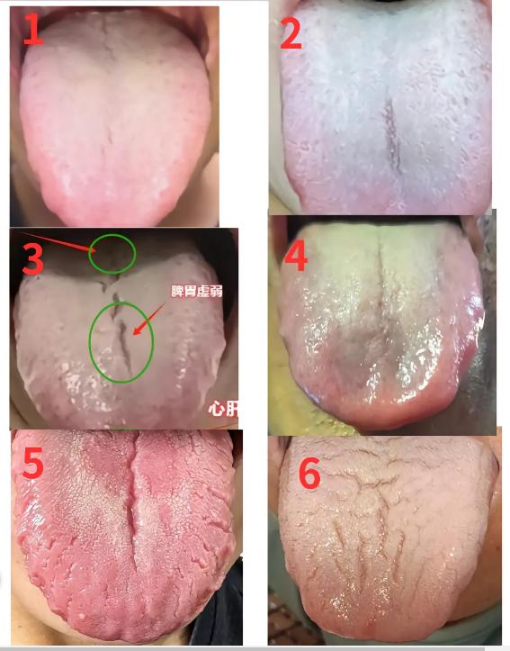 那方面差？看看你的舌象像下面哪个？

今天比较空闲，你拍，我来分析！