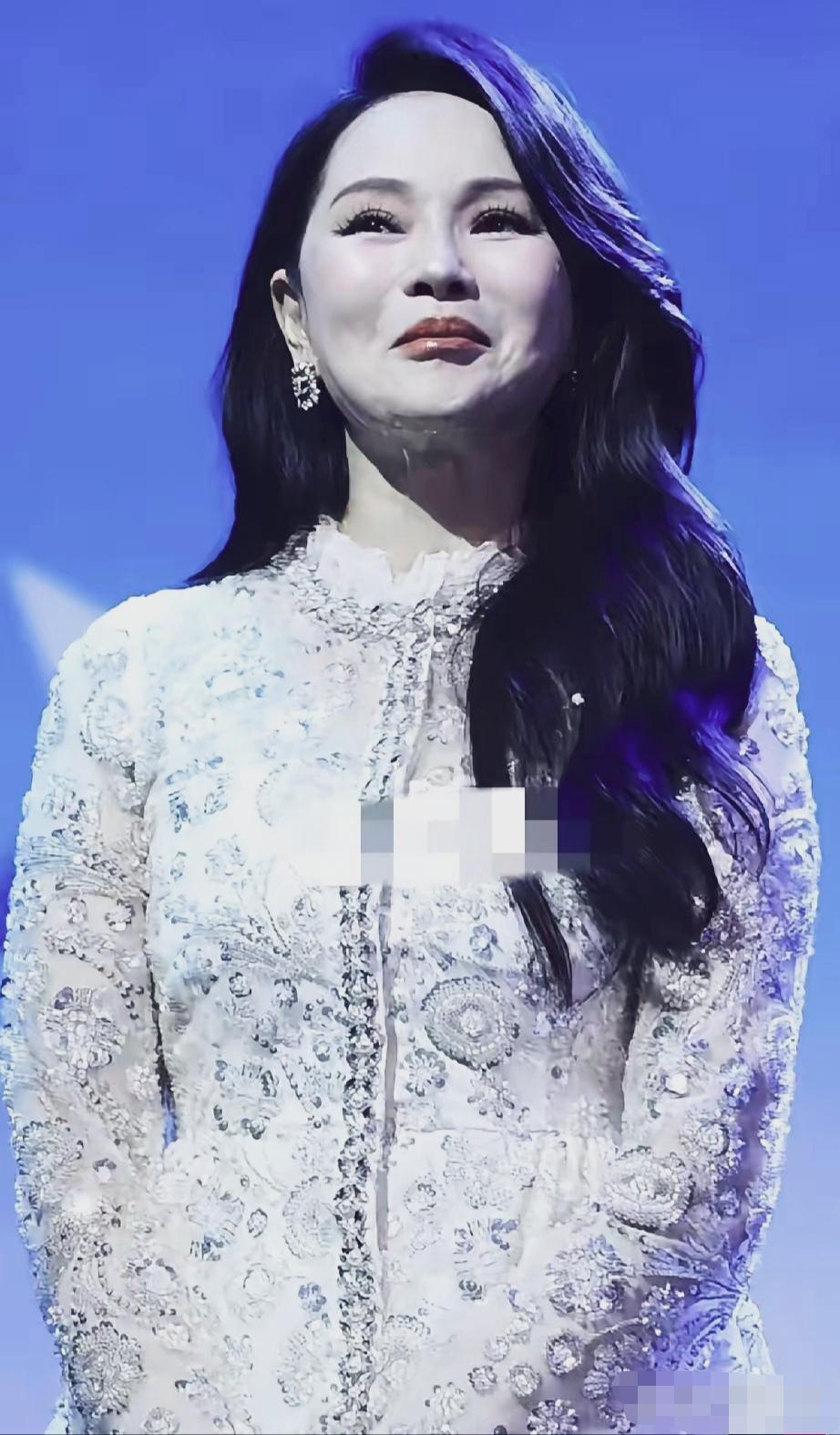 老了就自然接受，医美面部看起来真的很不自然。