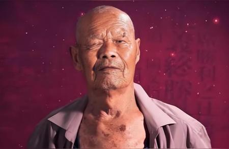 1956年，35岁的农民咳嗽10年，但却一直拒绝就医，一天，他突然用力一咳，一个