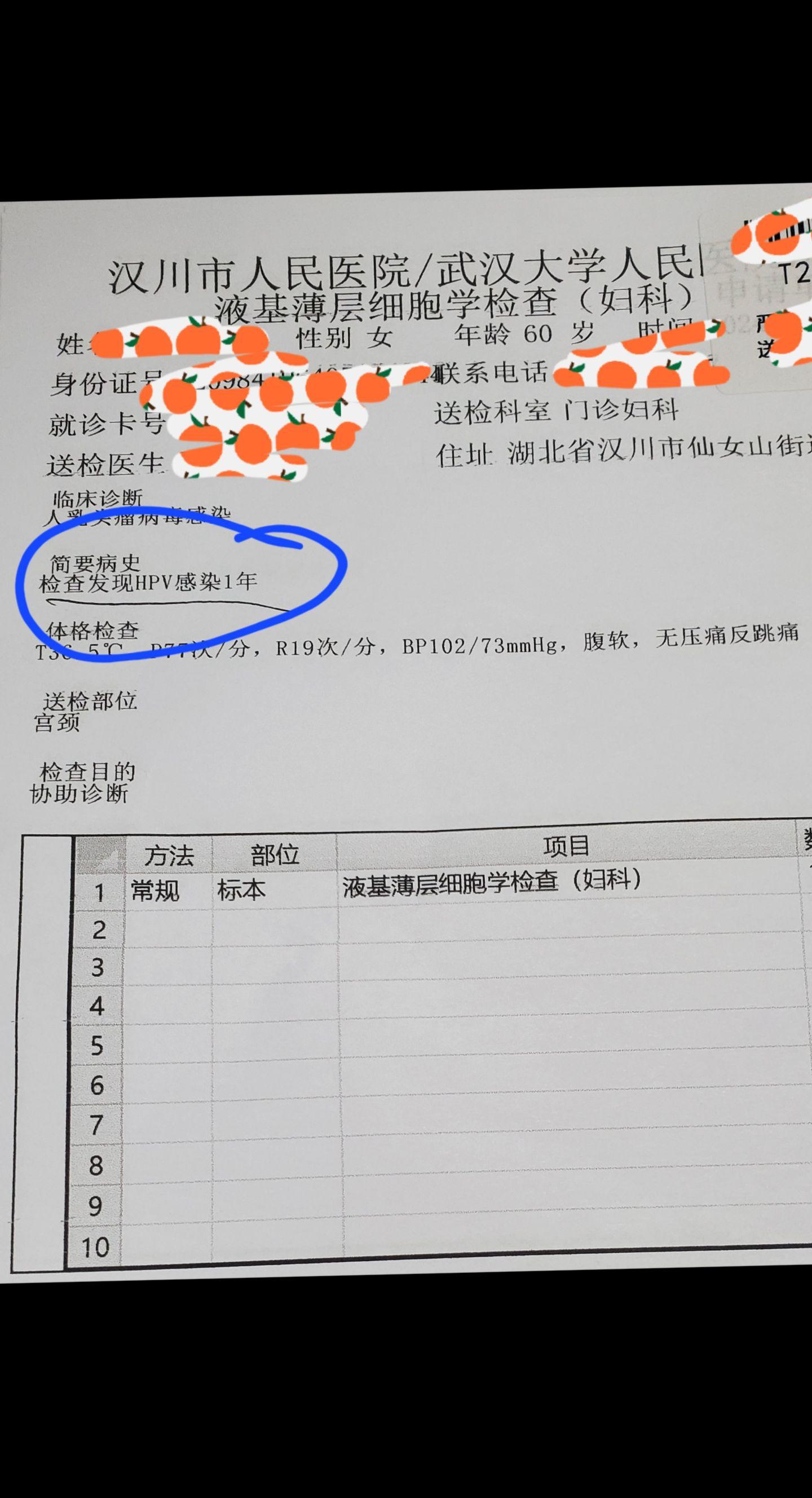 hpv感染