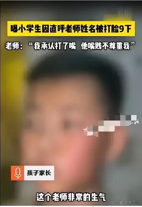 山东济宁，小学五年级学生上课大声呼喊50多岁数学老师的名字，被老师找出后打脸9下