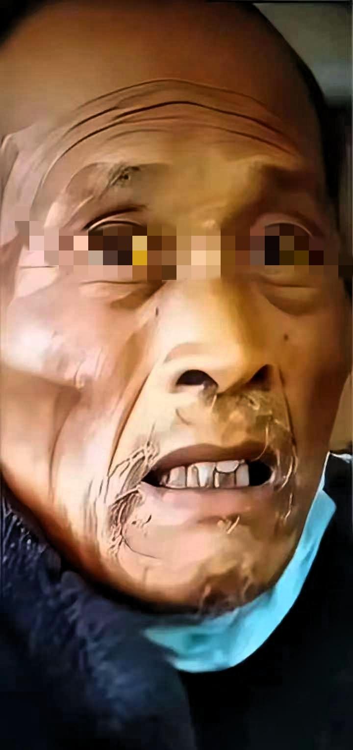 遗憾一生！父亲在医院被检查出肝癌中期，儿子因手里没钱，骗父亲说：医生说了，目前对