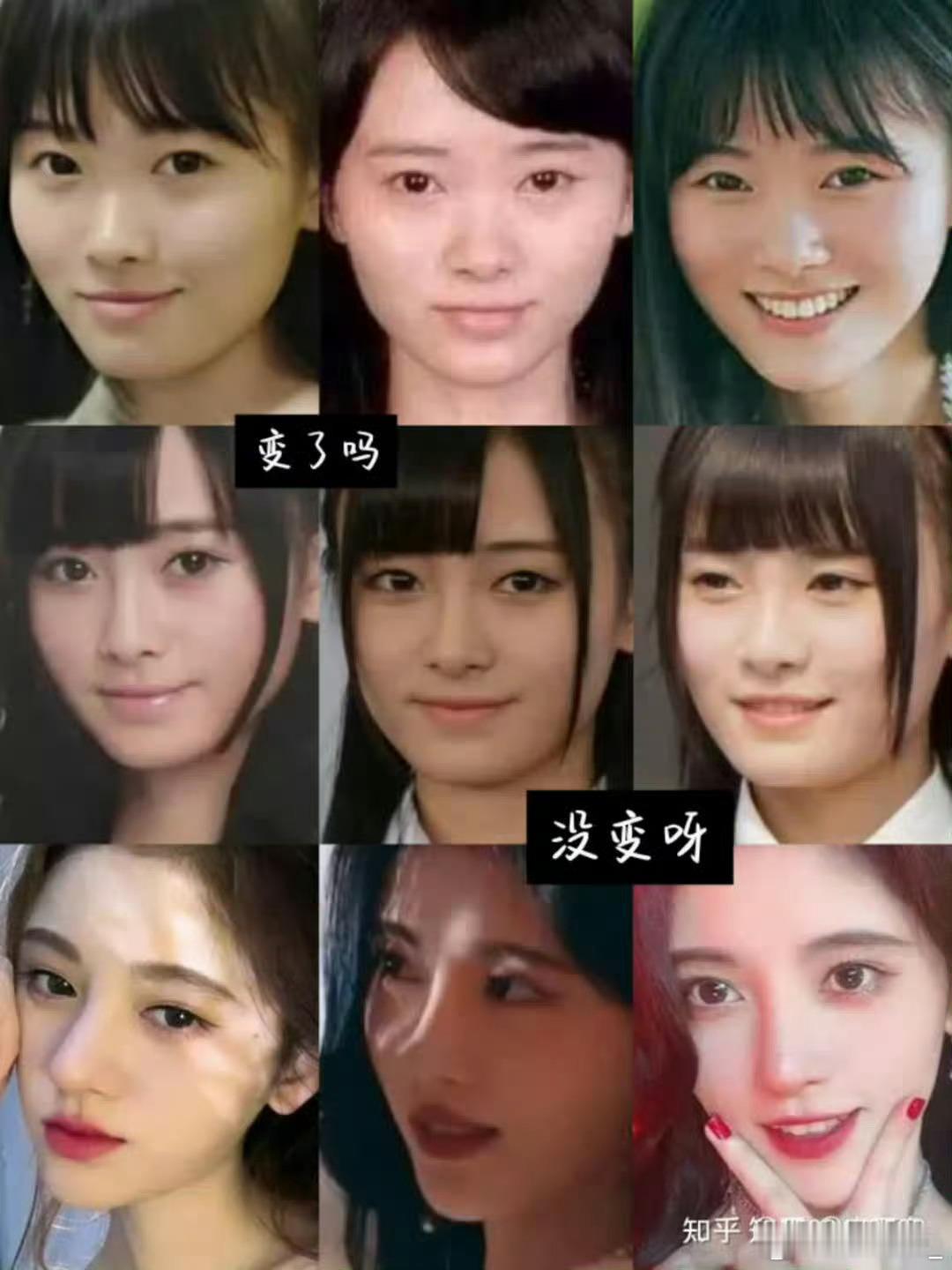 鞠婧祎田曦薇脸部变化史，谁打的🪡最少？ 