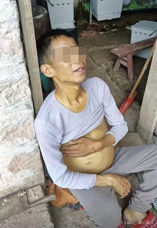 参加完大伯的葬礼，我下定决心，一定不能这样死去，选择不了生，我一定要选择怎么死。