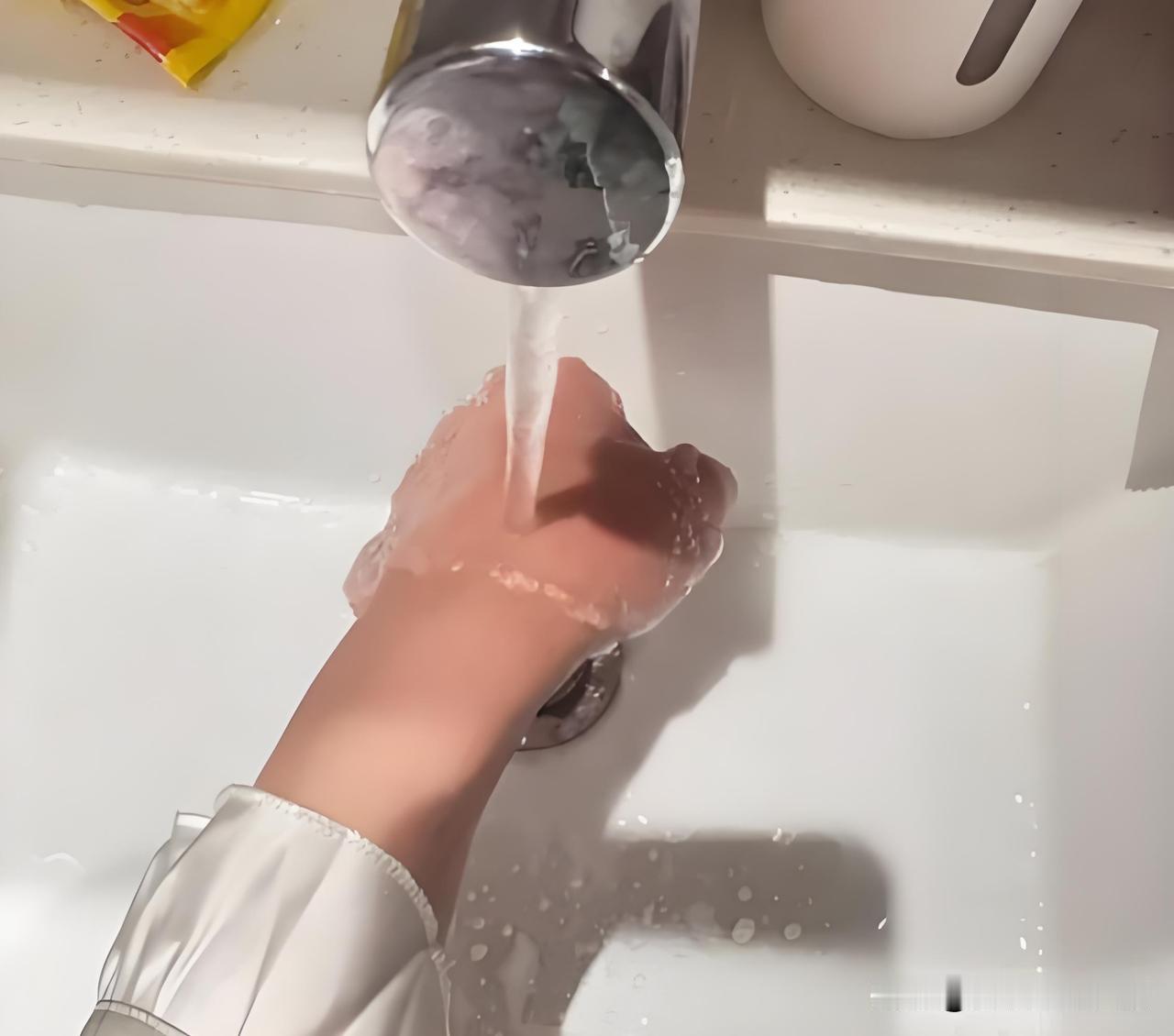 山东一女子做饭时不慎被高温热油烫伤手臂，第一时间就把伤处放在流动水下持续冲洗，整