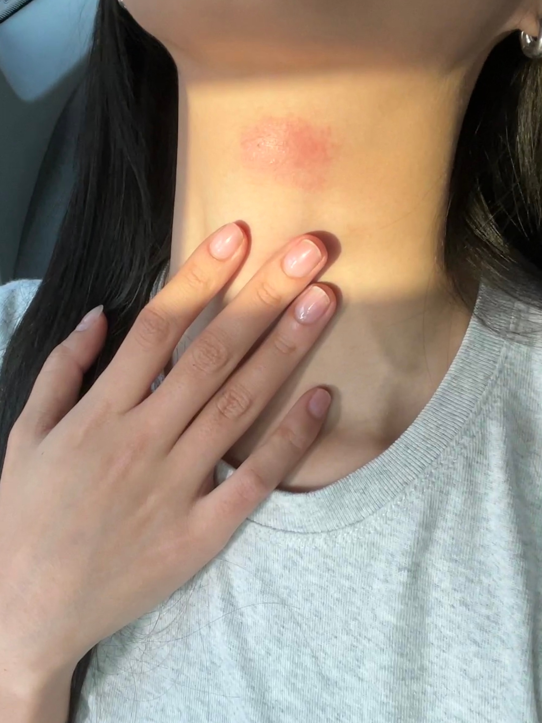 又又又又开始过敏了… ​​​