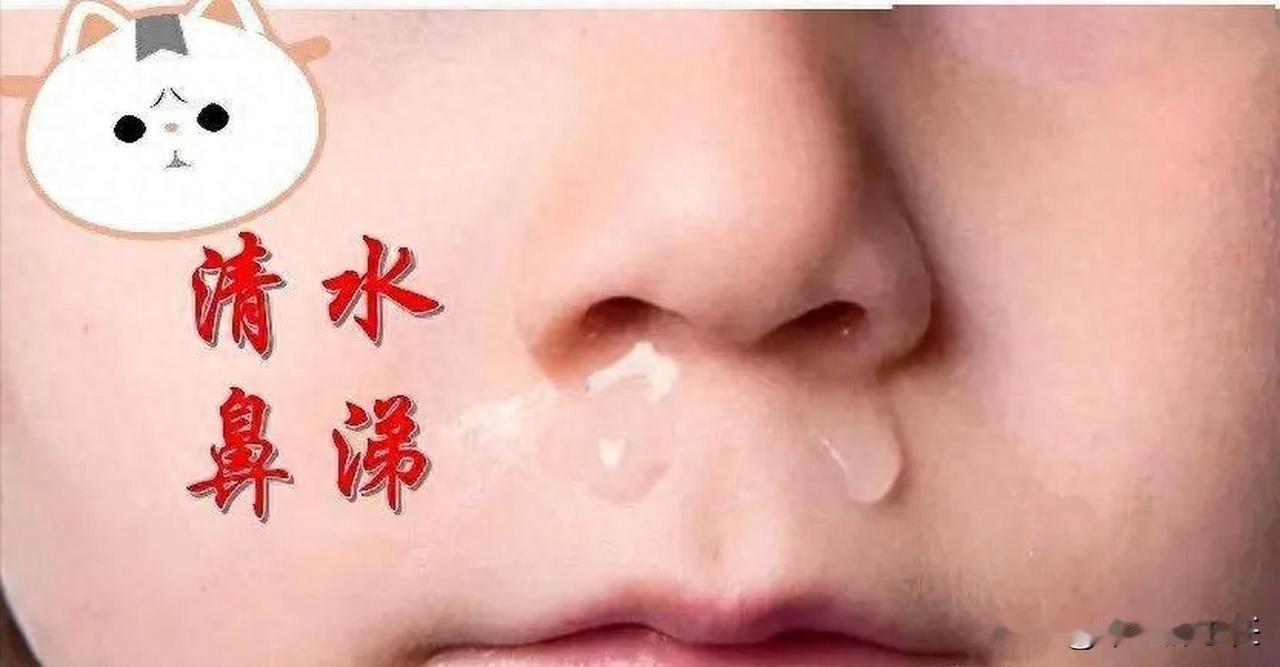孩子流鼻水，别急着用药！
家长们，你们有没有遇到过孩子单纯流鼻水，没有发烧也没有