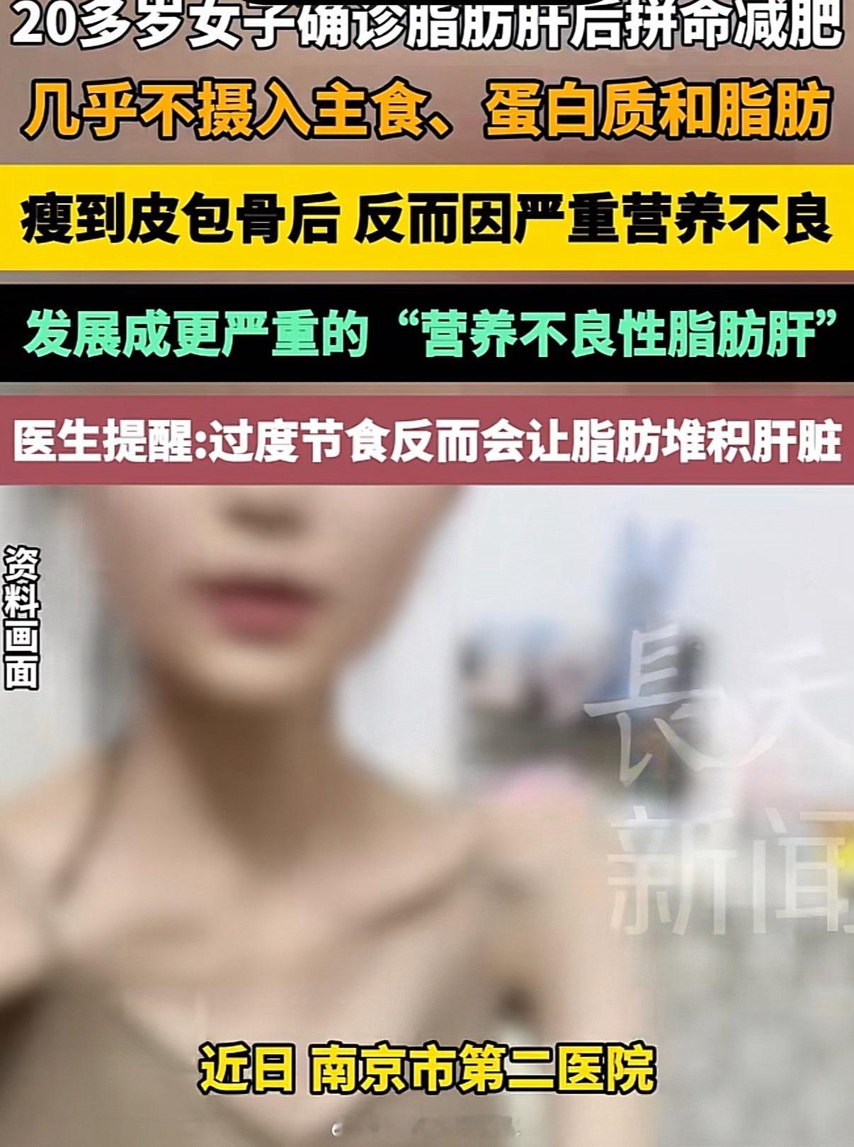 女子极端饮食月瘦20斤重度脂肪肝 主食得吃啊，碳水，脂肪，膳食纤维，蛋白质，都要