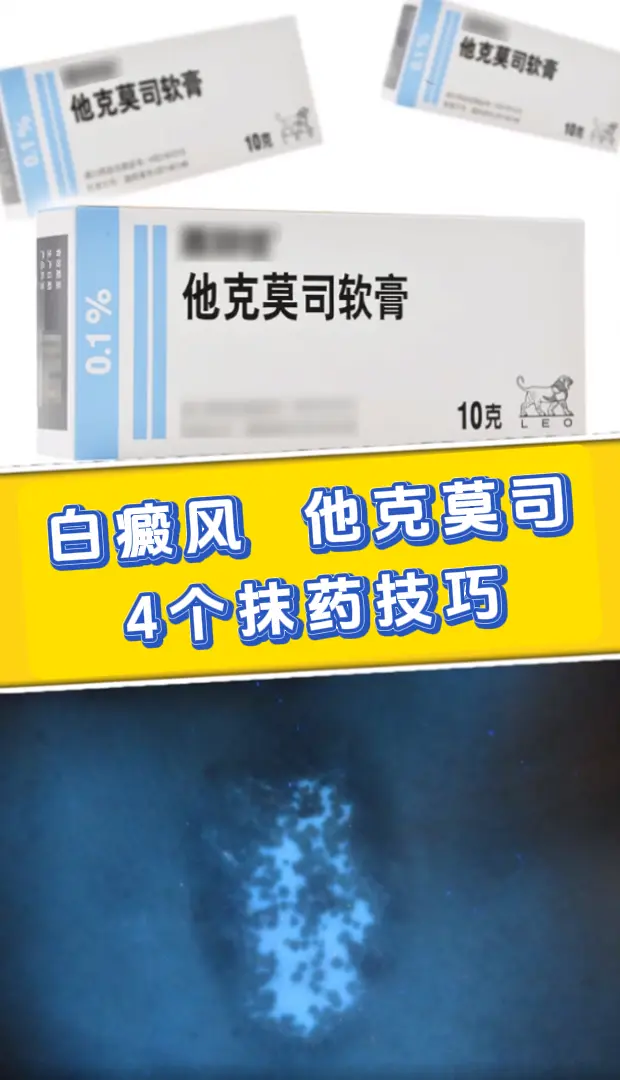 他克莫司正确使用方法： ①他克莫司软膏是一种钙调磷酸酶抑制剂，每天白斑...