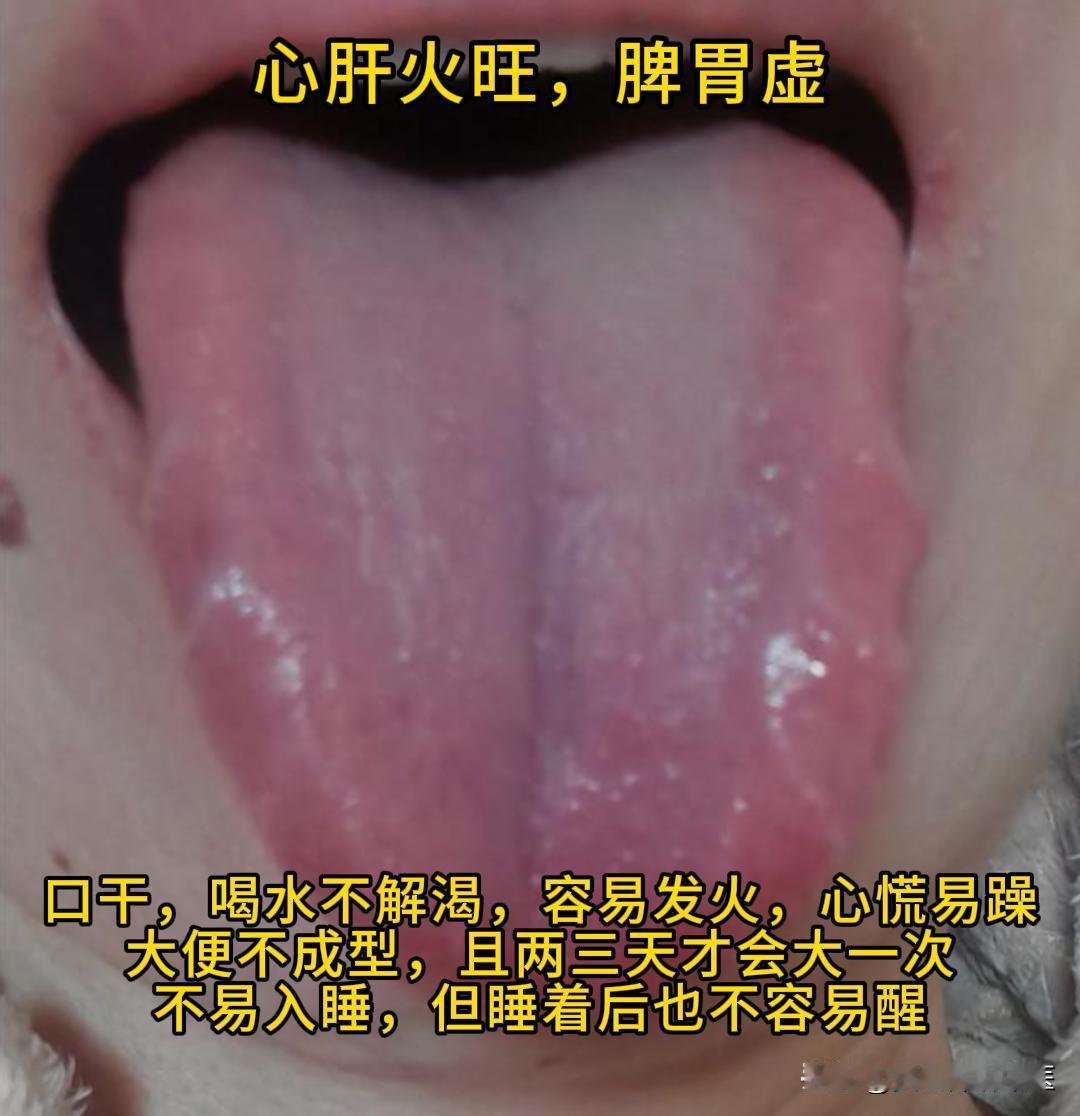 今日有时间，可以帮大家看看舌象。

有需要的，尽管把你的舌象照片发过来吧！越早发