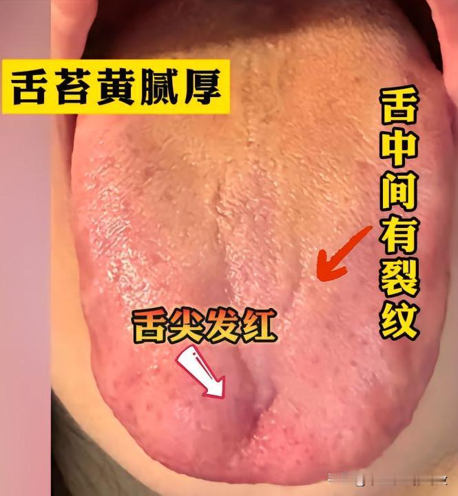 才刚刚29岁，你这房事三两下就结束，问题确实有点棘手[给力][给力][给力]
主
