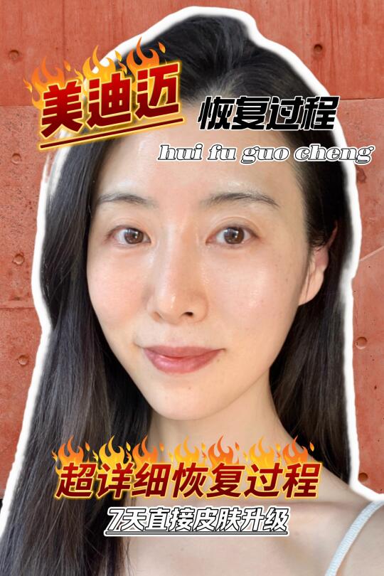 黄金微针🪡恢复全过程
