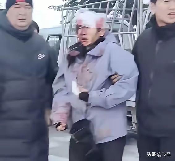 真是好奇害死猫啊！
这位女士也不年轻了，怎么还有那么强的好奇心啊！什么都想体验！