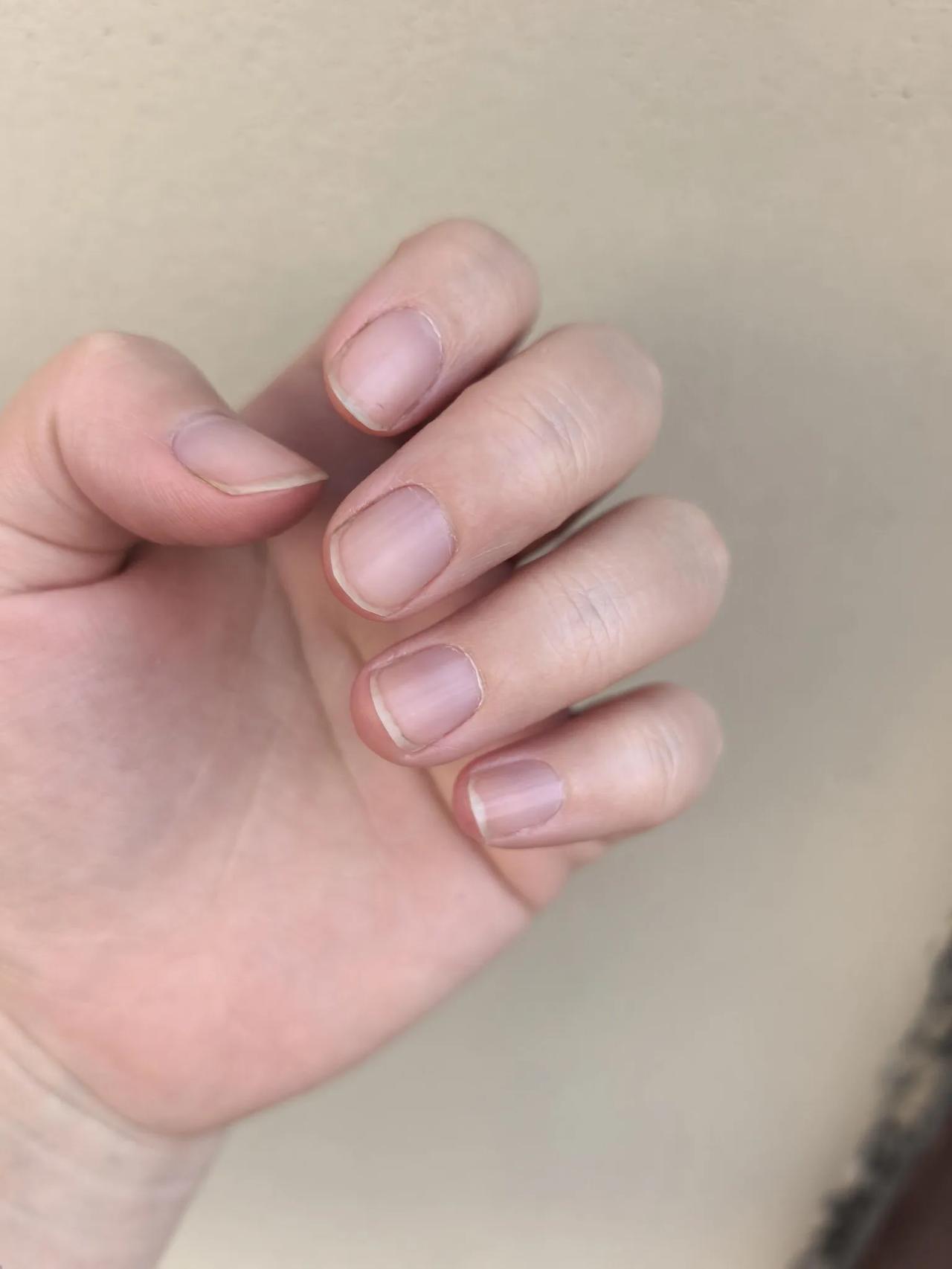 没有月牙就算了，为啥会黑紫色
关于上一篇好多网友说我是天冷了冻的，
正好今天户外