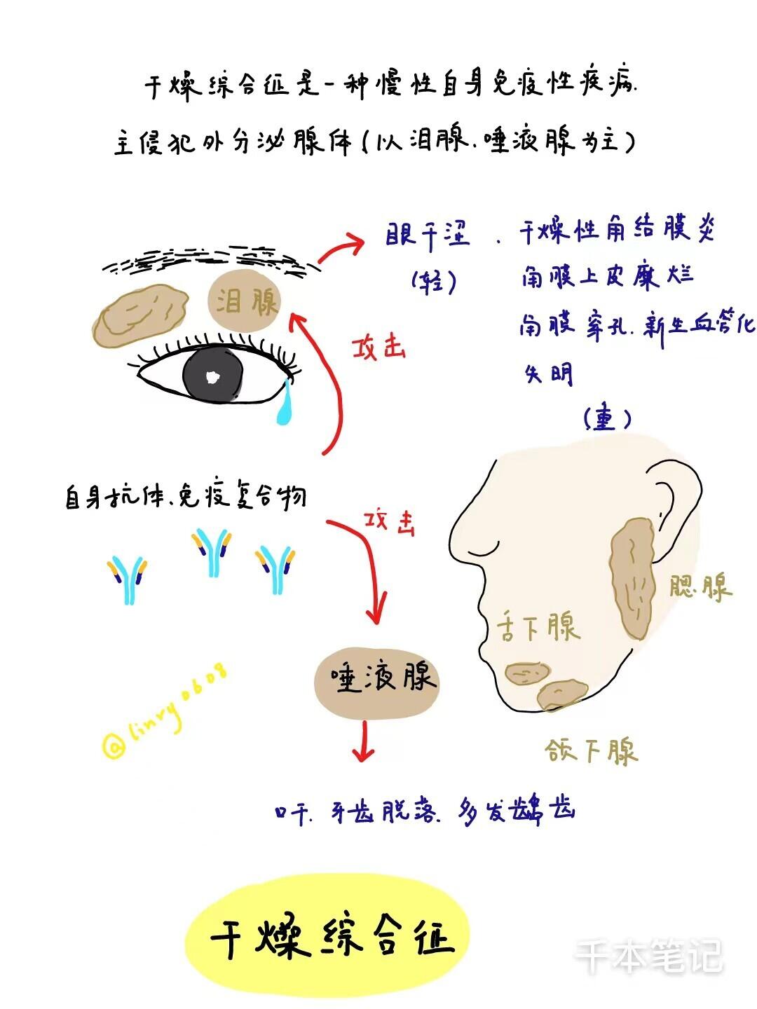 医学生绘本🎨第93弹【干燥综合征】