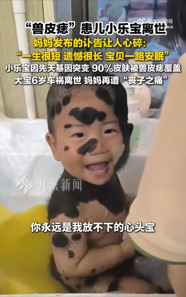 小乐宝妈妈再遭丧子之痛

6月13日，备受关注的 “兽皮痣” 患儿乐宝离世，其母