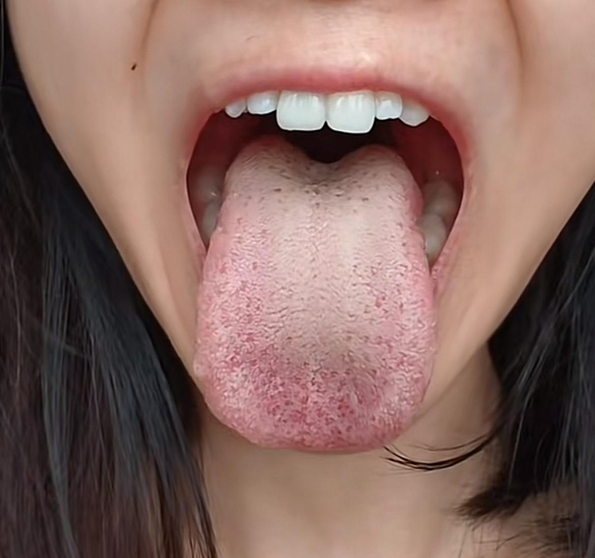 越看越不对劲， 越看心里越难受，我感觉废了[偷笑]
患者自述：入睡困难，熬夜多，