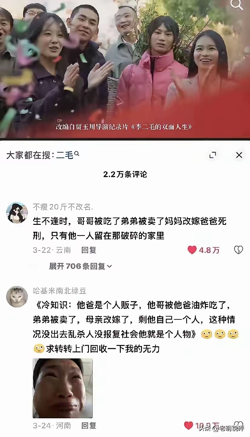 不仅地狱开局，他的人生也是一个极恶劣的玩笑，做了上身假体想变性，结果没钱做下体，