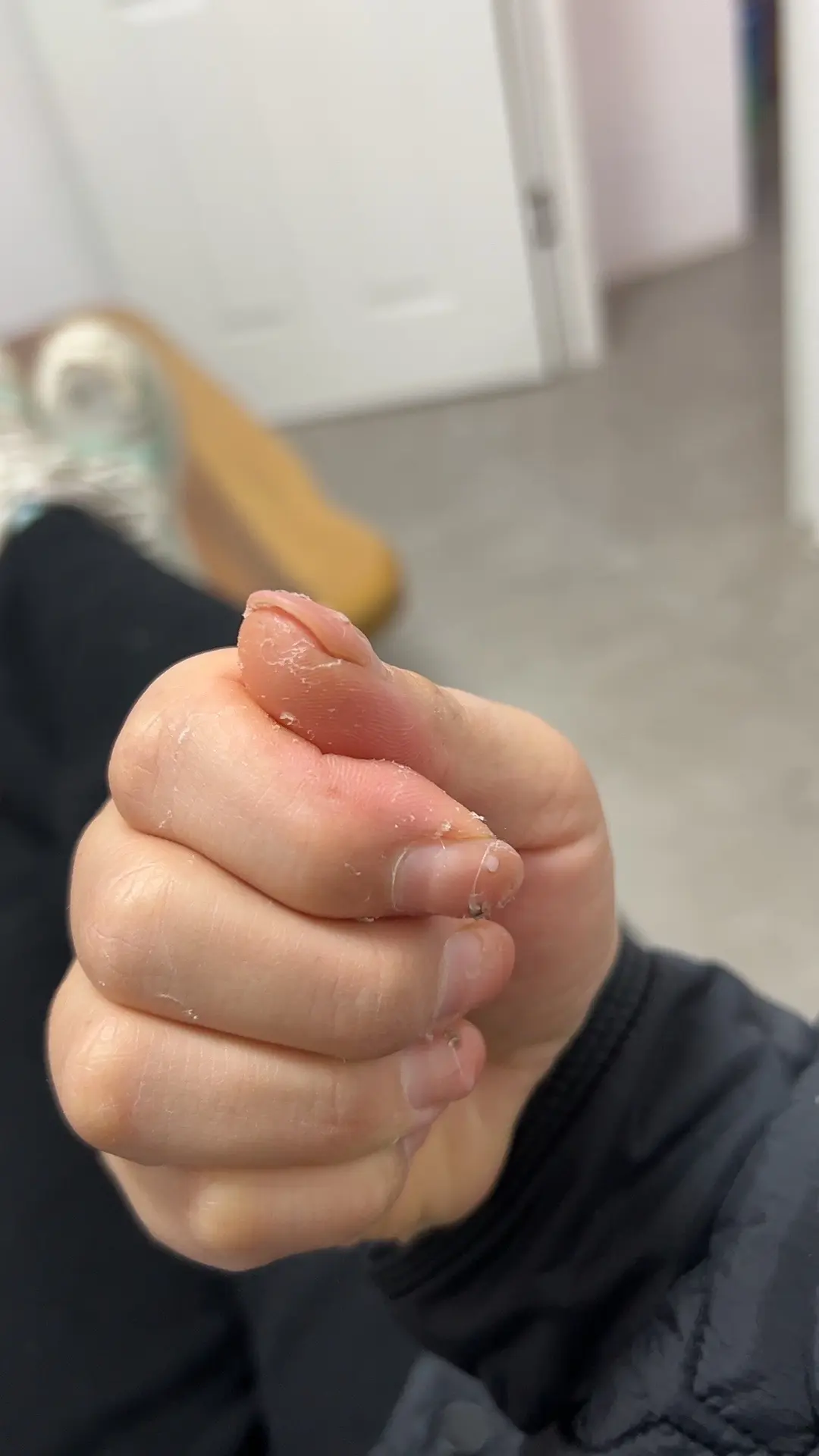 我的手没护手霜拉到你的手的时候，你会不会嫌我的手太粗糙