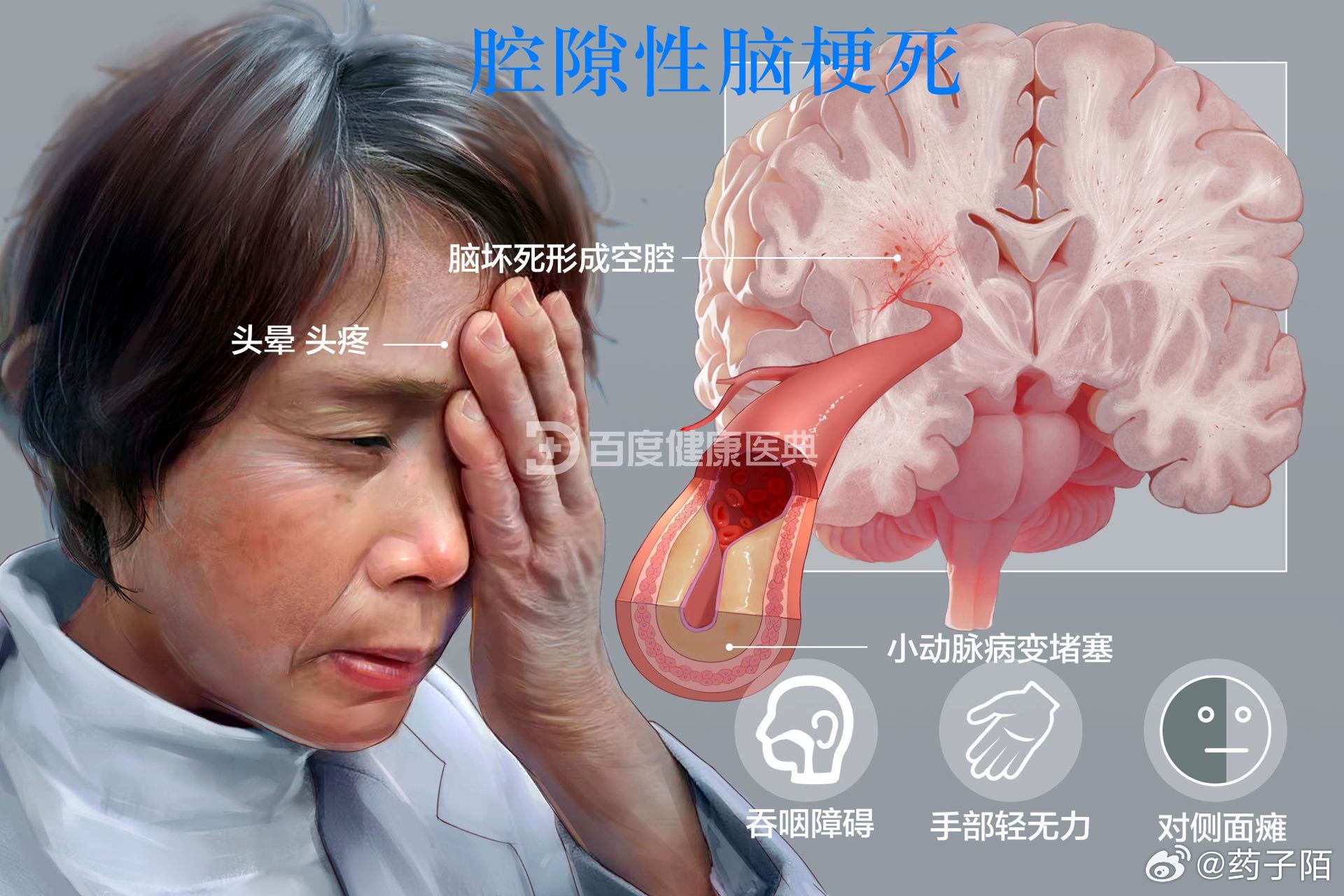 ⁉️什么是腔隙性脑梗死✔️腔隙性脑梗死属于脑梗塞的一种类型🔷是指大脑半球或脑干