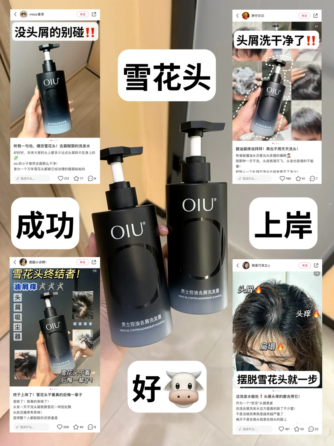 去屑战士！雪花油头快看过来…