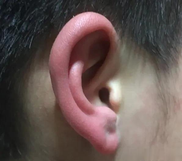 小儿内热有5大类，你家孩子占了几个？

1、胃热：口臭、不爱吃饭或食欲旺盛，咳嗽