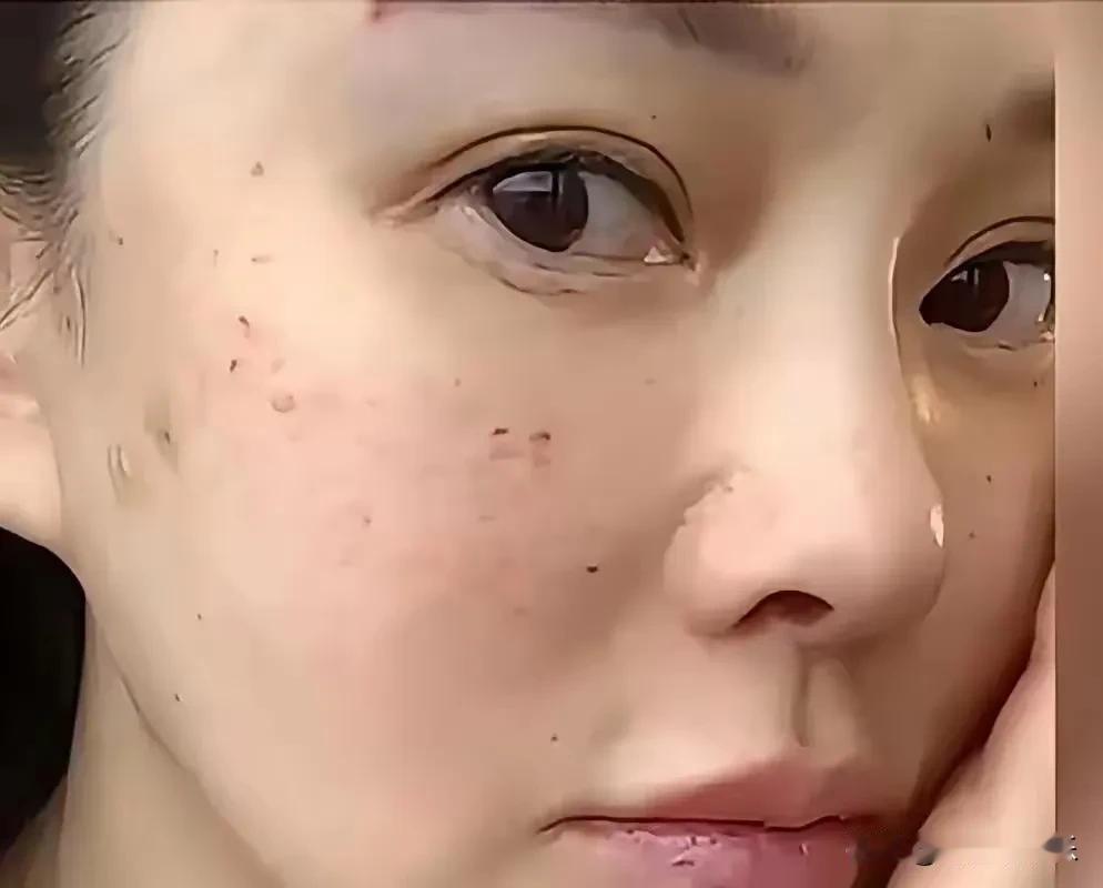 伊能静对自己下手真够狠的，
为了美一点也不怕疼，
由容嬷嬷而来的“我扎不扎你就完