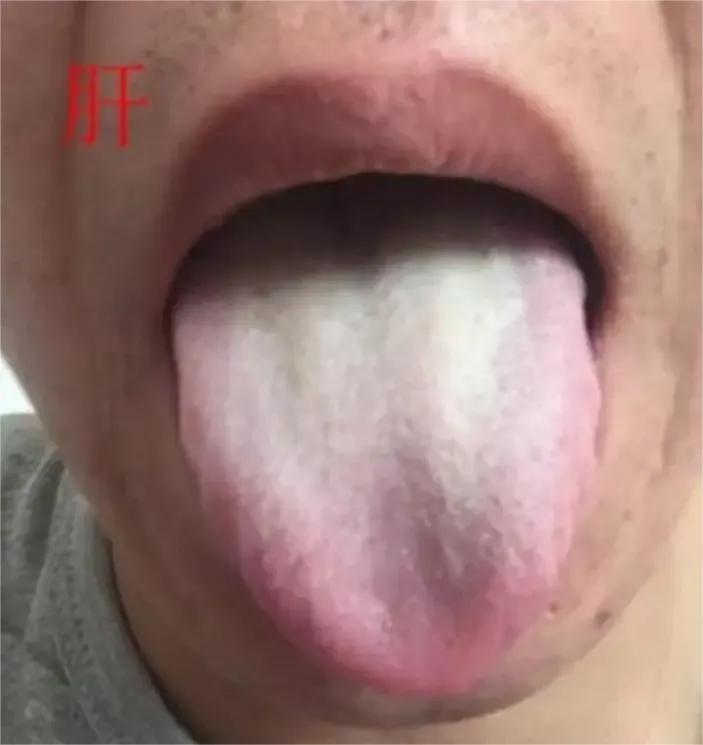 还在为身体问题烦恼吗？肝主硬度、肾主时间、脾主体力，今天一个文章教会你如何补足肝