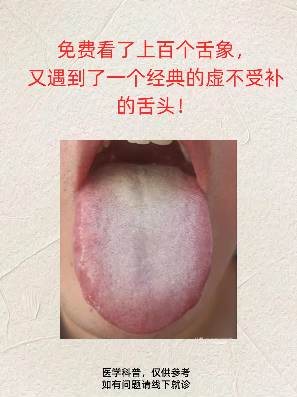 免费看了上百个舌头，又遇到个虚不受补的！都说了800遍了，不要随便补，还是有人记