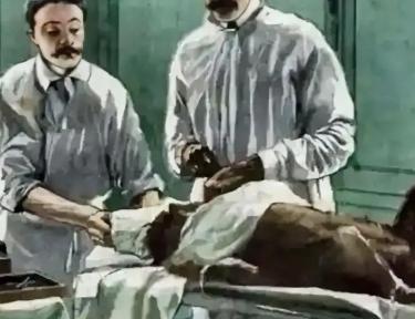 1920年，一名俄裔医生脑洞大开，把猴子的睾丸移植到74岁老人身上，怎料，手术做