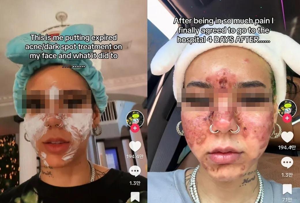 当化妆品变“化妆杀手”：小心！过期美妆品让你“颜值”暴跌！

你是否曾想过，那些