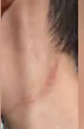 上海，一女子带着7岁患有鼻炎的儿子去一家国际医院，检查中，需要用一根30到35厘