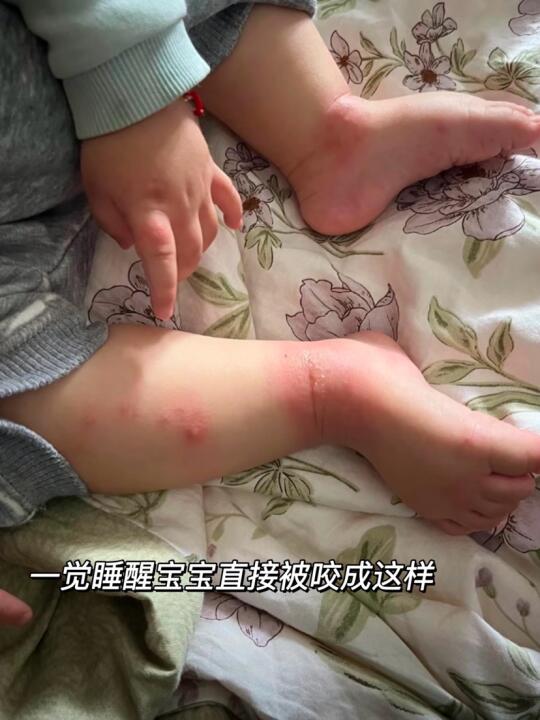 怎么还有宝妈认为驱蚊喷雾是智商税