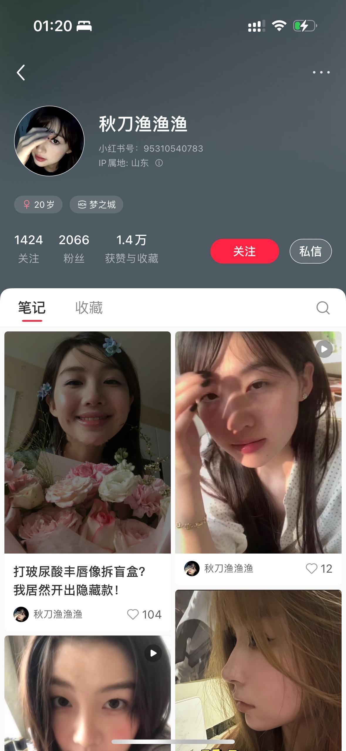 我遇到什么暗黑势力了[衰][衰][衰] 给我p成猪油嘴特效了 说我打了玻尿酸 ？