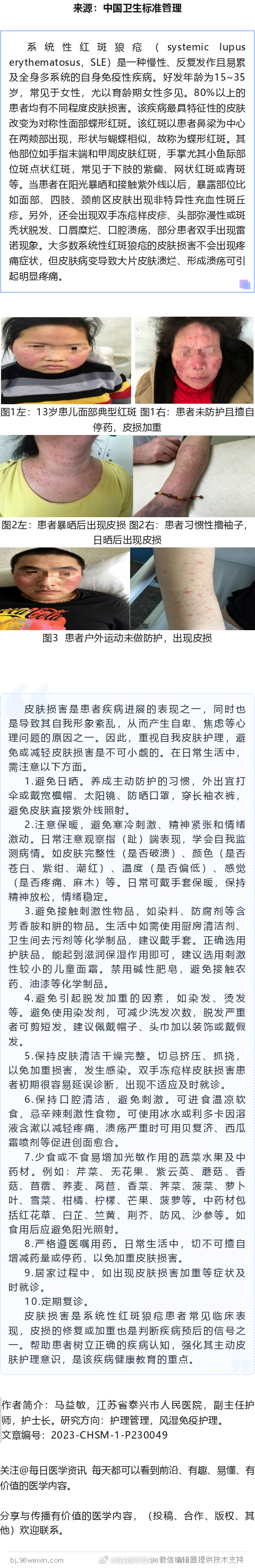 #医生在科普# 重视日常皮肤护理，减轻狼疮皮肤损害系统性红斑狼疮（systemi