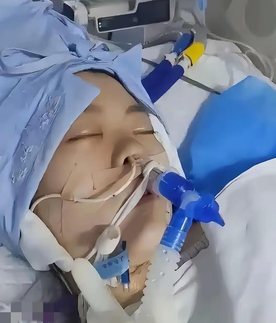 2022年，高三女生在高考前，在家吞药而亡，父母忍痛把她的器官全部捐出来，就在父