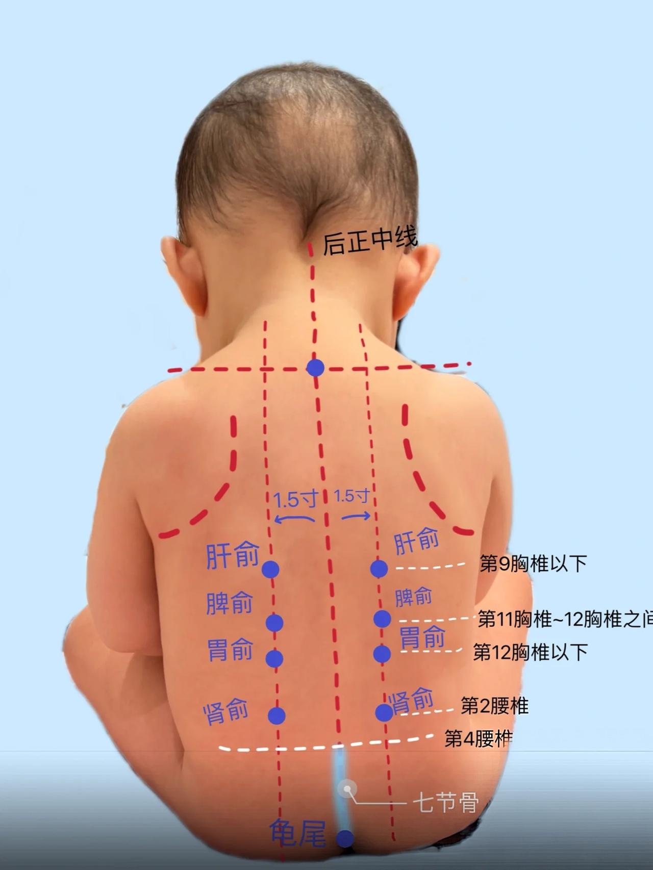 5岁 男孩 咳嗽前先吸一口气，苔薄白 舌尖少苔 辨为太阴气虚夹湿 灸身柱加脊中三